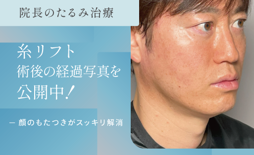 院長の糸リフトレポート
